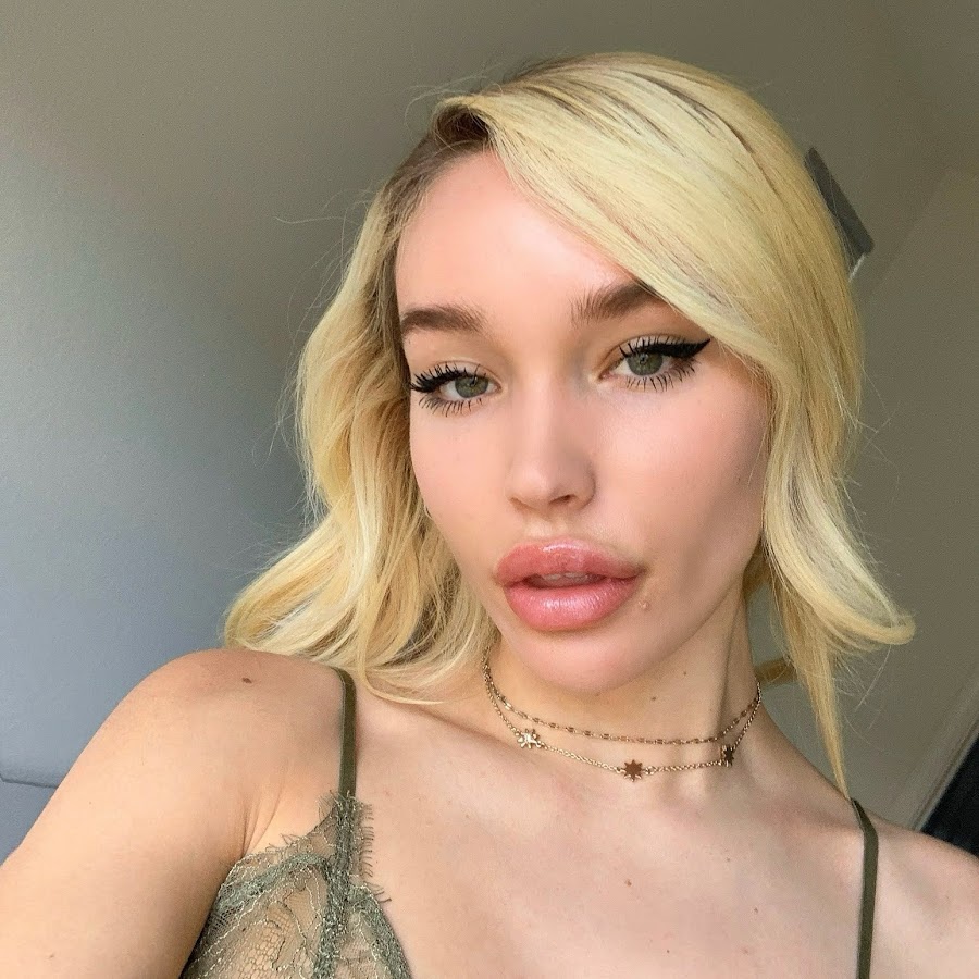 Who is Rara Knupps? Age, Career, Family, Net Worth, Height Bio 2024